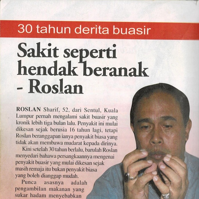 Artikel Buasir